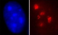 Forr�s: Stem Cells