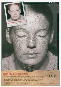 Forrás: American Academy of Dermatology Forrás: American Academy of Dermatology